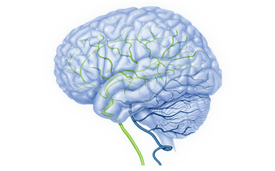 strokeupdate